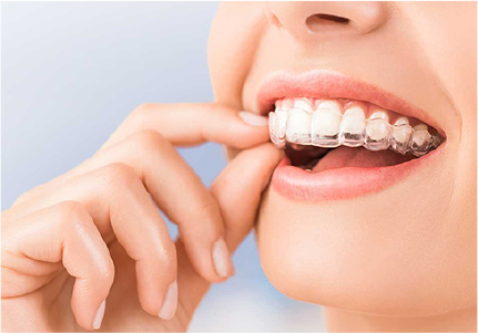 目立たない矯正治療